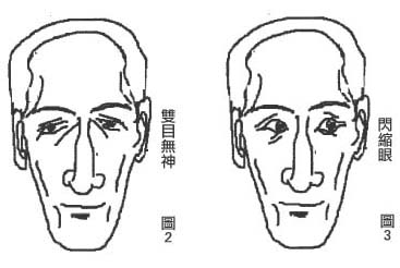 孤峰鼻代表什么